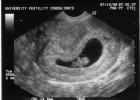 What does the fetus look like at 8 obstetric weeks?