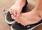 Desquamation des orteils - causes de la desquamation de la peau Pelage de la peau entre les orteils d'un enfant